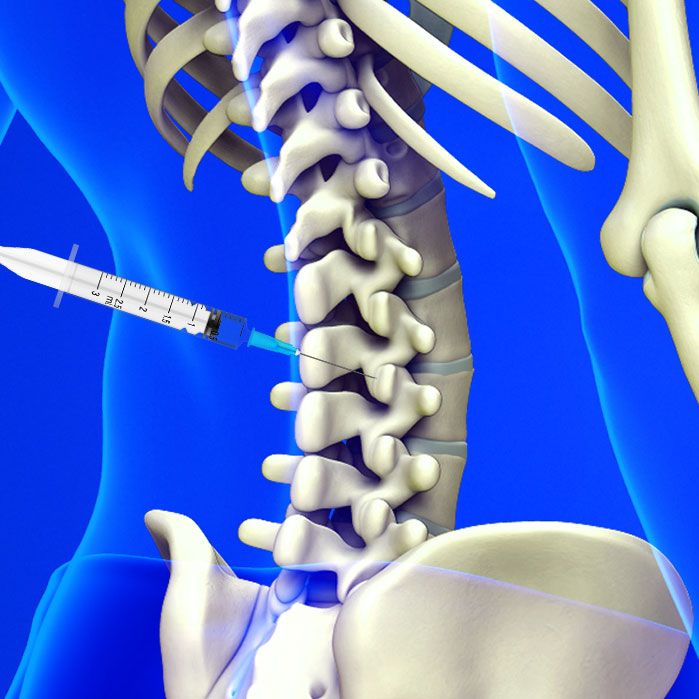 facet joint injections in Garland