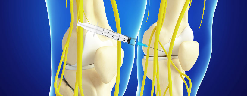 patient receiving Genicular Nerve Block in Garland for auto accident injury pain relief