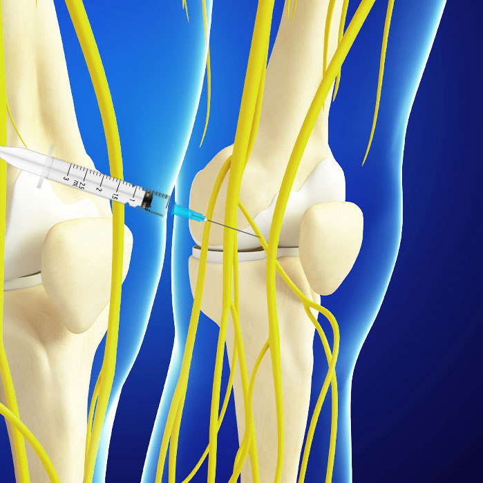 genicular nerve block in Garland