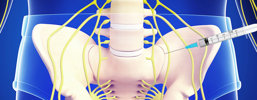 patient receiving Sacroiliac Joint Steroid Injections in Garland for auto accident injury pain relief