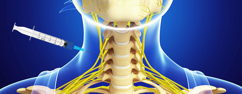 patient receiving Stellate Ganglion Block in Garland for auto accident injury pain relief